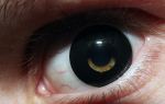 Dusturbing Eye